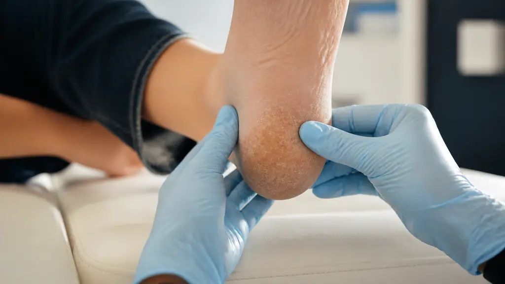 Excès de kératine peau : causes et soins des zones cornées